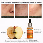 Suero Rejuvenecedor de Vitamina C - Sérum blanqueador y antiage