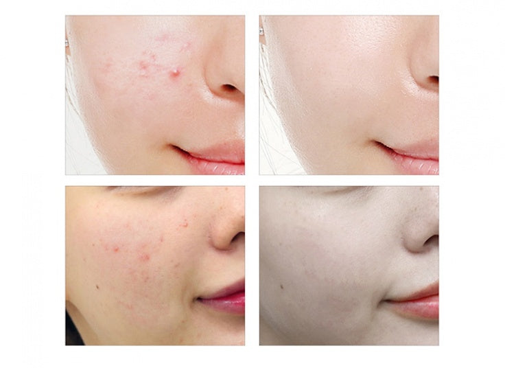 Ginseng® Serum Antioxidante Rejuvenescedor - 49% OFF + ENVIO GRATIS