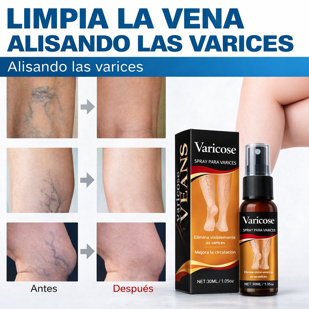 Spray para el alivio de las varices: fórmula natural de rápida absorción para la hinchazón, el dolor y el cansancio de las piernas.
