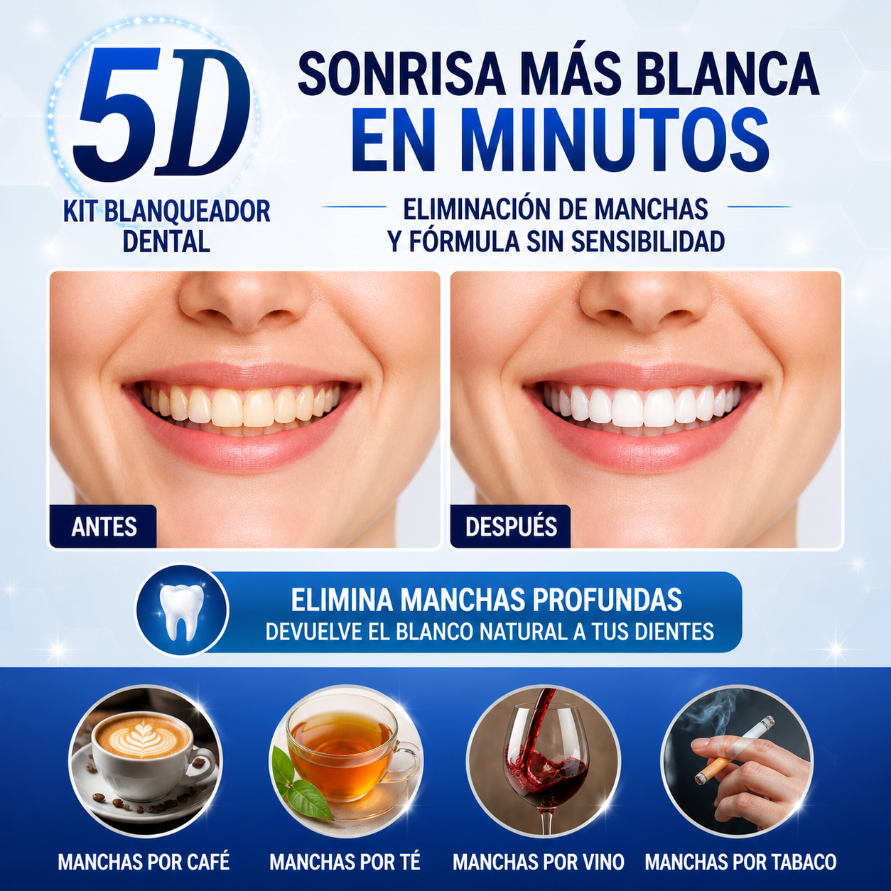 Kit Blanqueador Dental 5D – Sonrisa Instantáneamente Más Brillante, Eliminación de Manchas y Fórmula Sin Sensibilidad