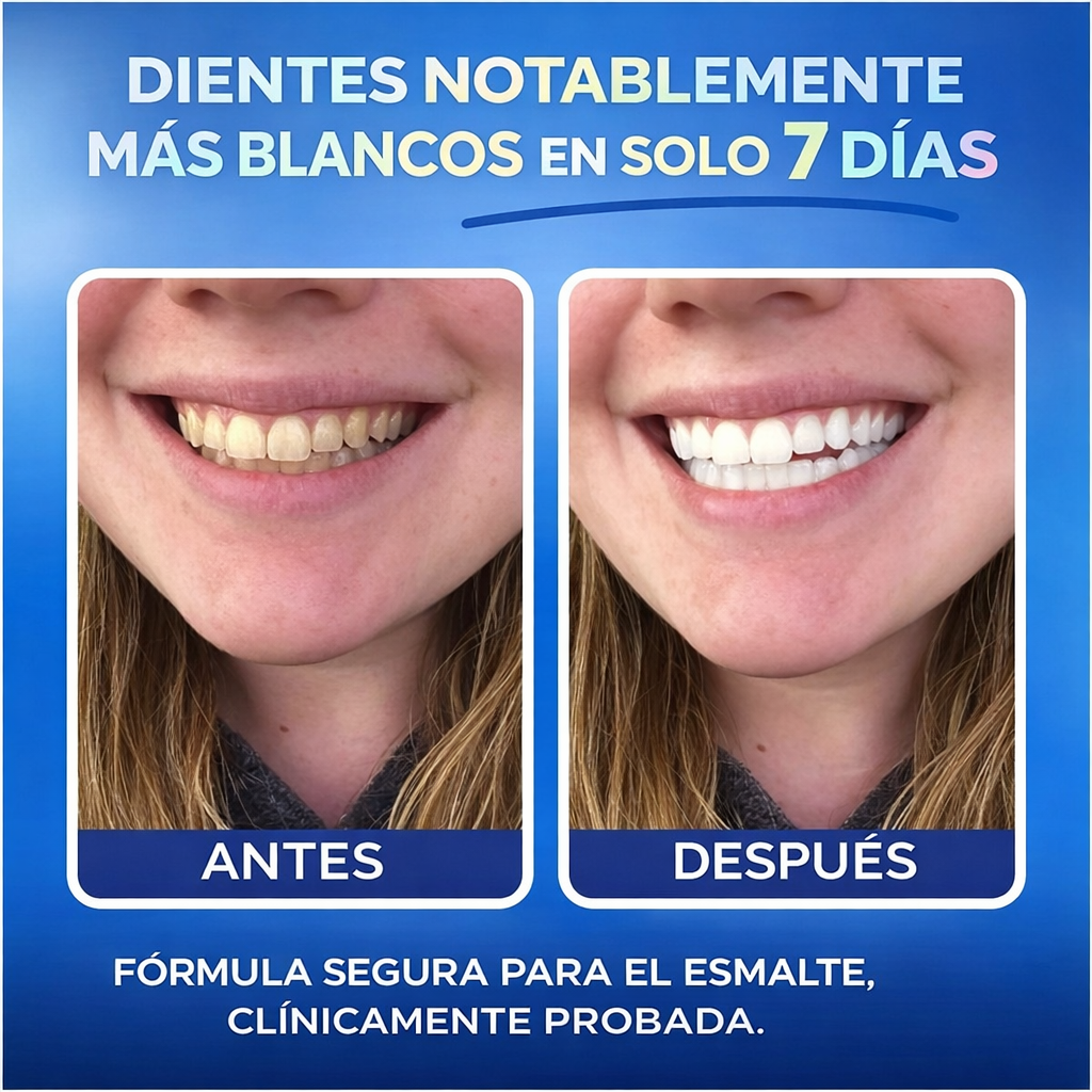 🦷 5D White Pro – Blanqueamiento Dental Profesional en Casa
