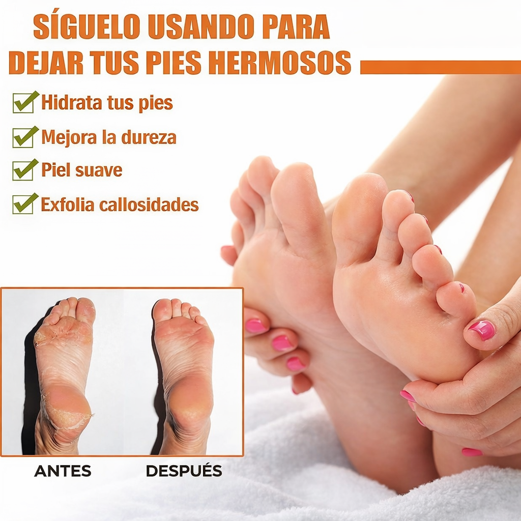 Spray Removedor de Callosidades para Pies - Elimina la aspereza, exfolia la piel seca e hidrata los pies.