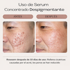 SERUM CONCENTRADO DESPIGMENTANTE  - Fórmula profesional para piel más uniforme
