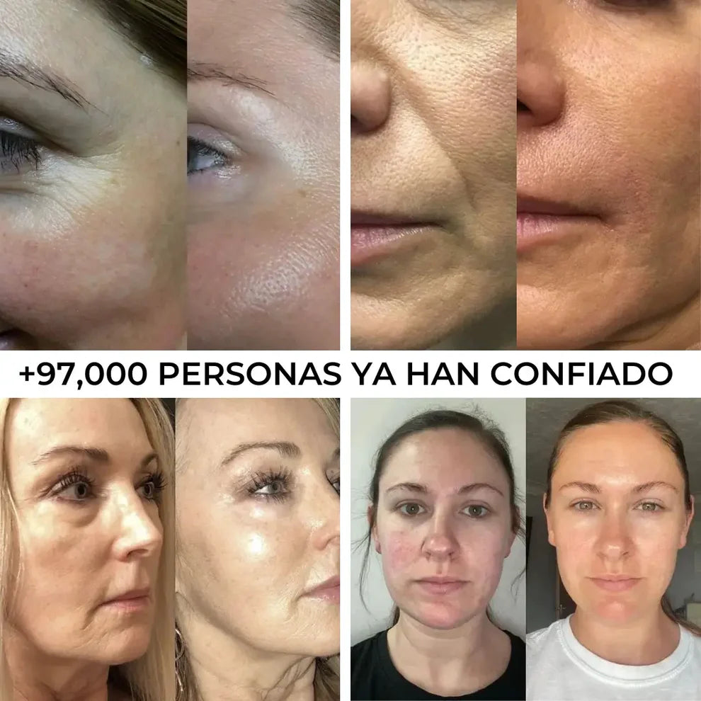 Suero Reparador Ultra Hidratante - Hidratación Profunda • Reparación de la Barrera Cutánea