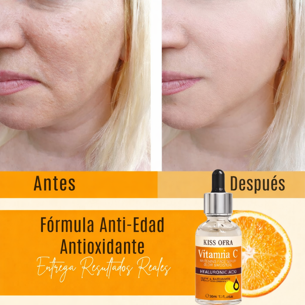 Suero Rejuvenecedor de Vitamina C - Sérum blanqueador y antiage