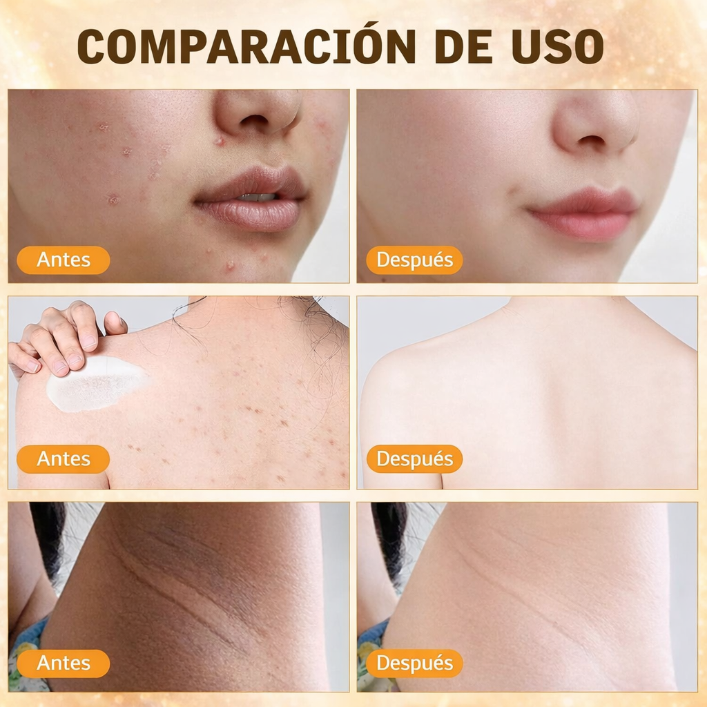 Crema Restauradora de la Piel con Veneno de Abeja - Hidratante 3 en 1 para todo tipo de piel