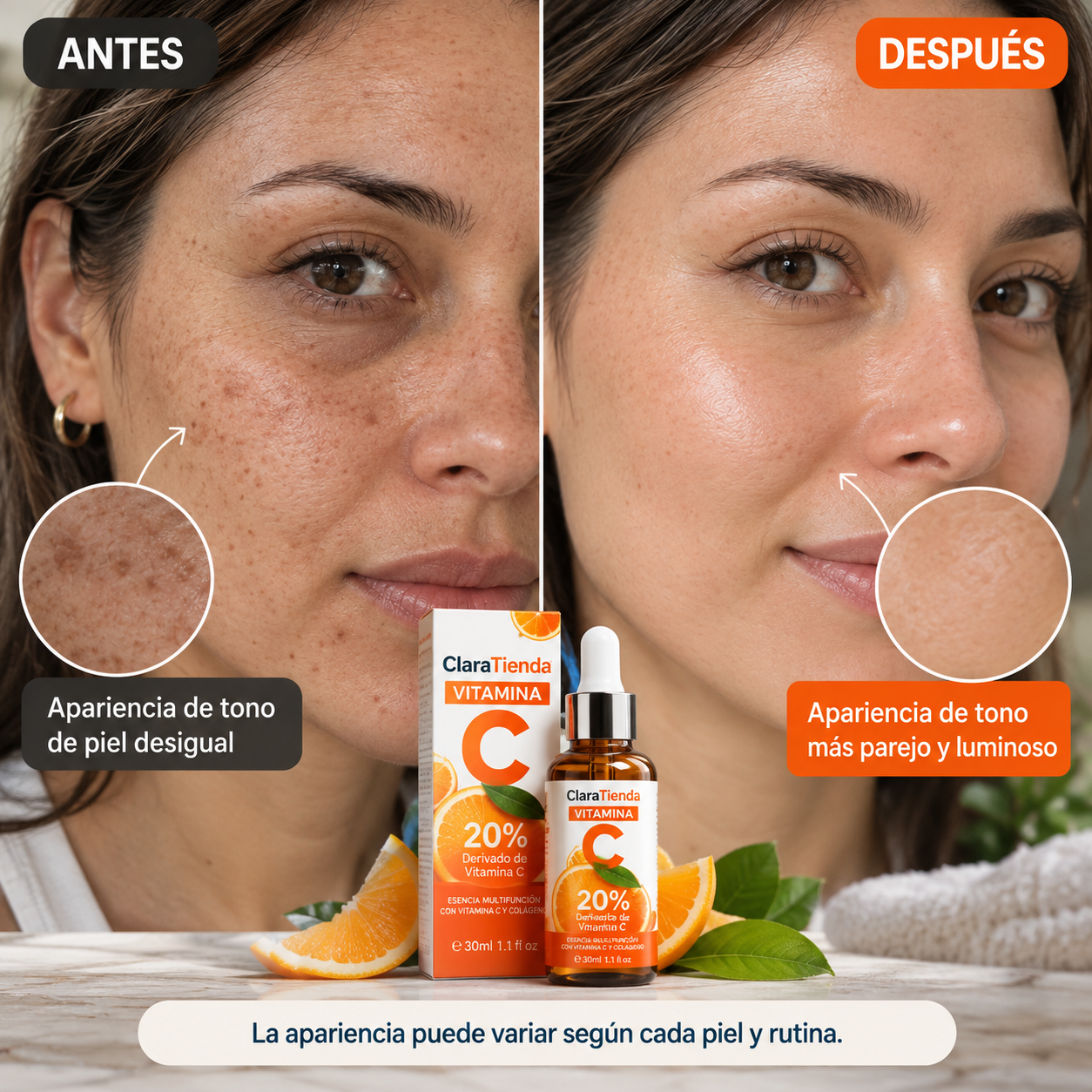 SÉRUM FACIAL DE VITAMINA C - Ayuda a Reducir la Apariencia de Manchas