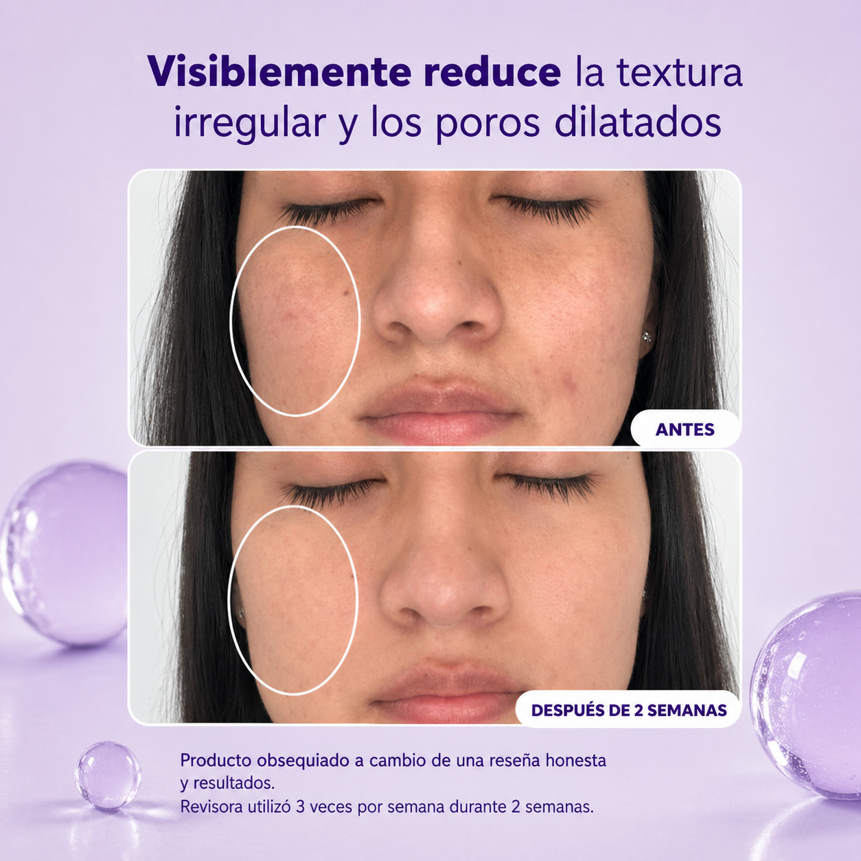Niacinamida Serum - De imperfecciones visibles a una piel con aspecto impecable