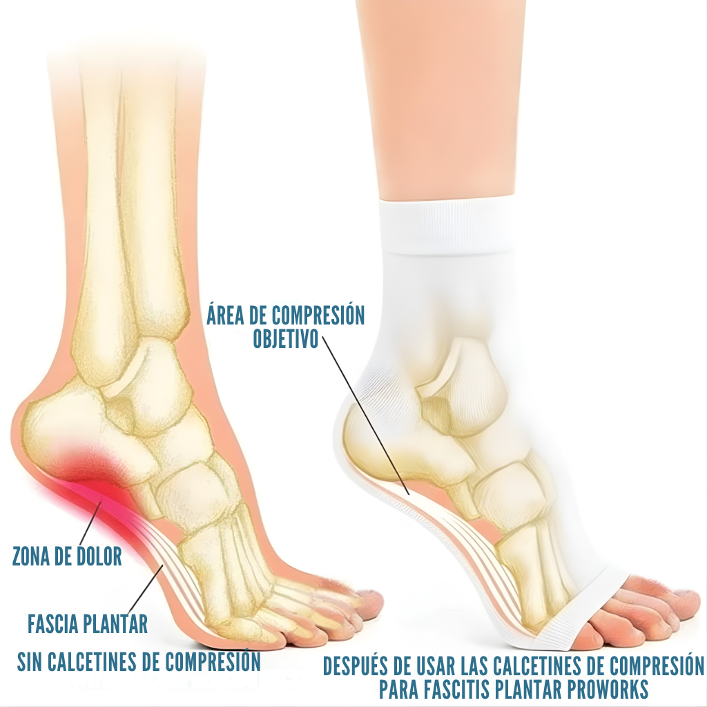 Calcetines para neuropatía: soporte de compresión para tobillo