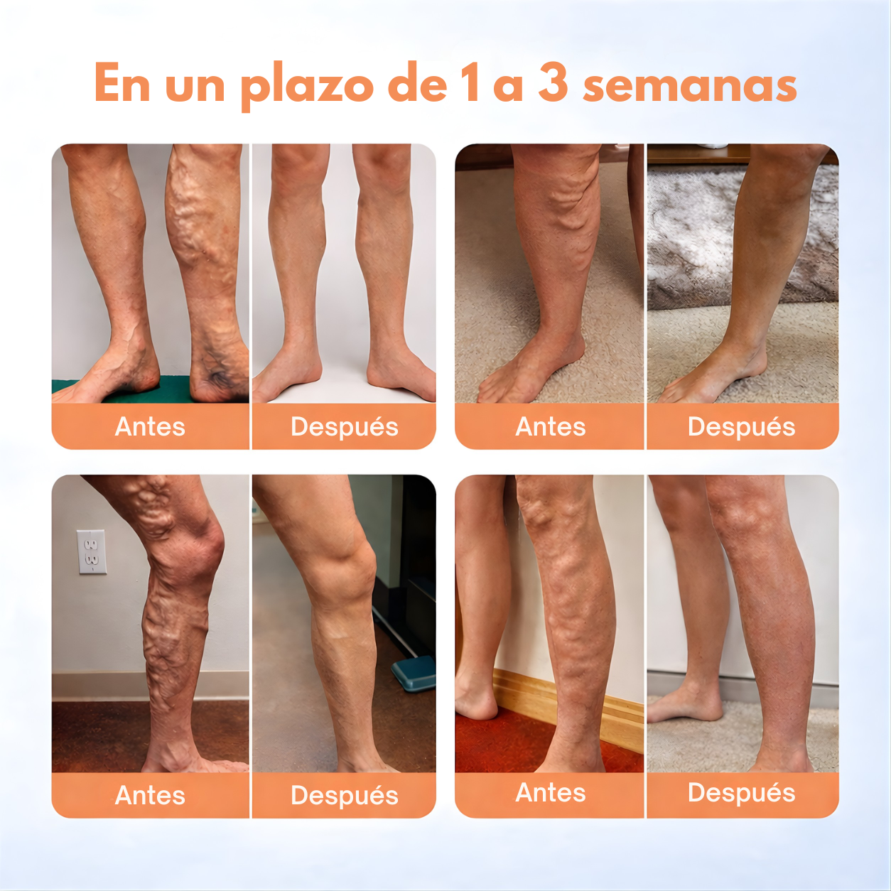 Beevena Spray para Varices – Alivio Rápido y Llévate 2x1 Hoy (Piernas Ligeras Sin Dolor)