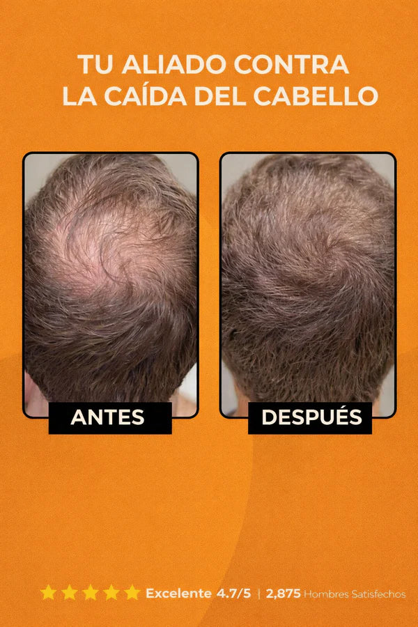 SPARTAN® – Shampoo Activador Capilar