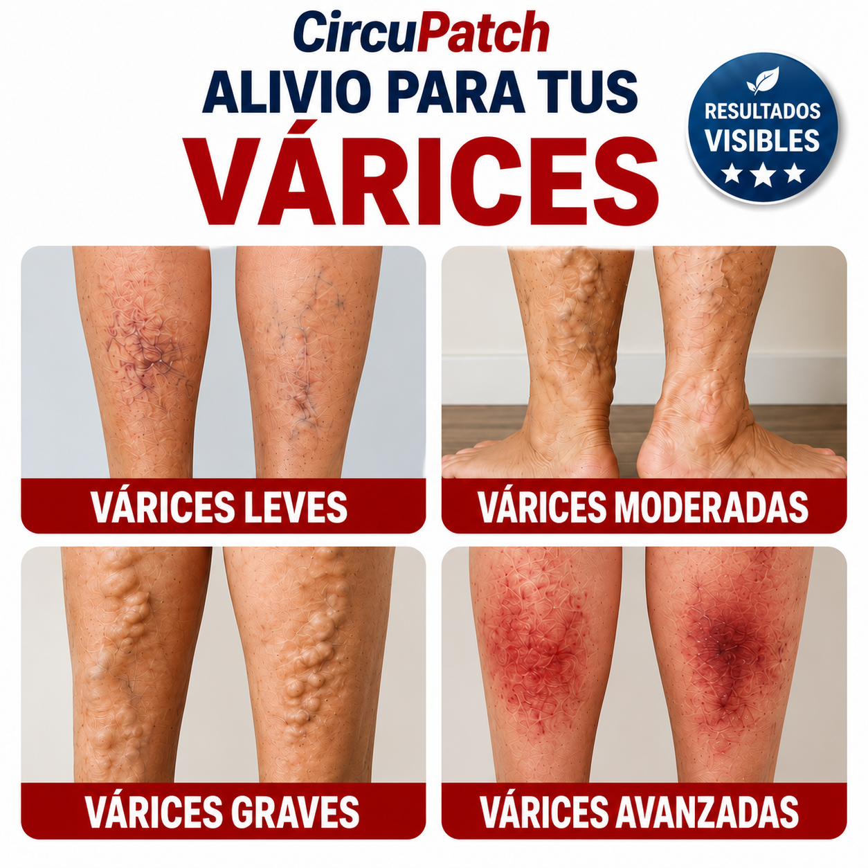CircuPatch: ¡Dile adiós a las varices y recupera la belleza natural de tus piernas!