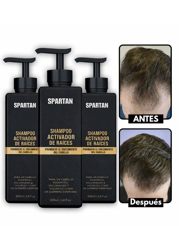 SPARTAN® – Shampoo Activador Capilar