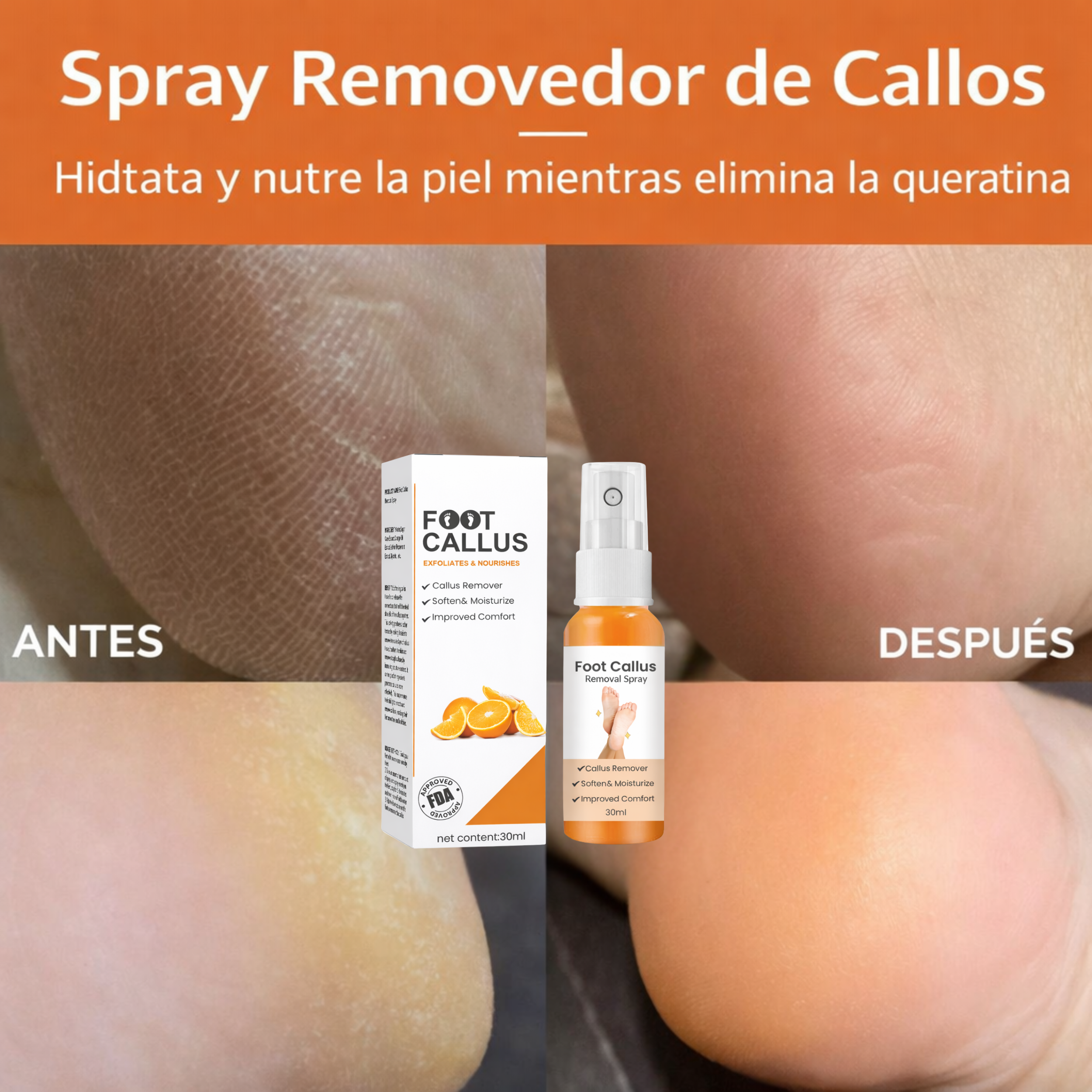 Spray Removedor de Callosidades para Pies - Elimina la aspereza, exfolia la piel seca e hidrata los pies.