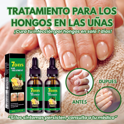 Tratamiento para los hongos de las uñas