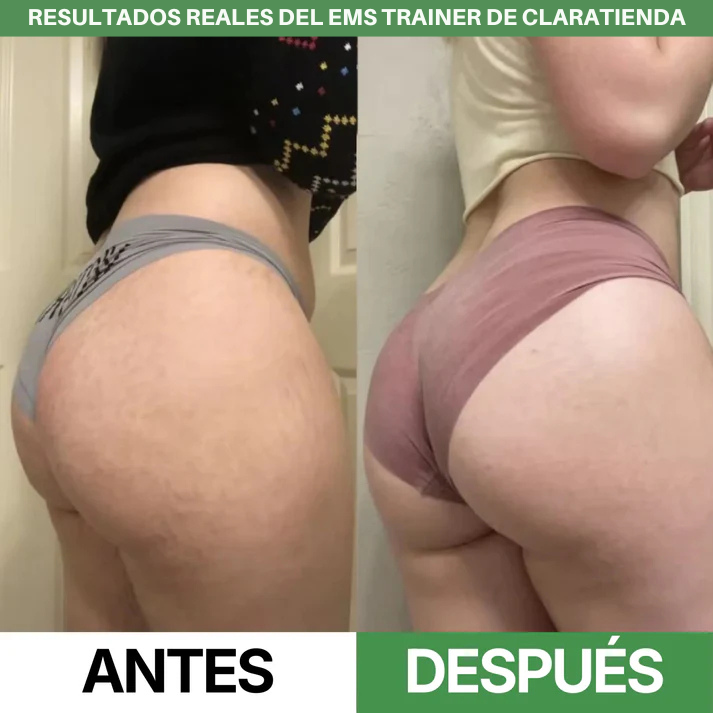 Entrenador EMS – Eleva y Tonifica tus Glúteos