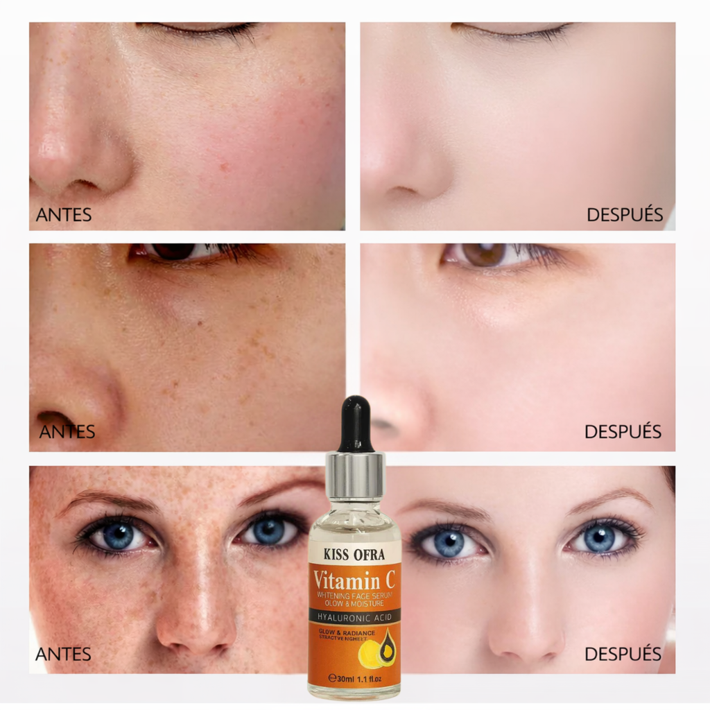 Suero Rejuvenecedor de Vitamina C - Sérum blanqueador y antiage