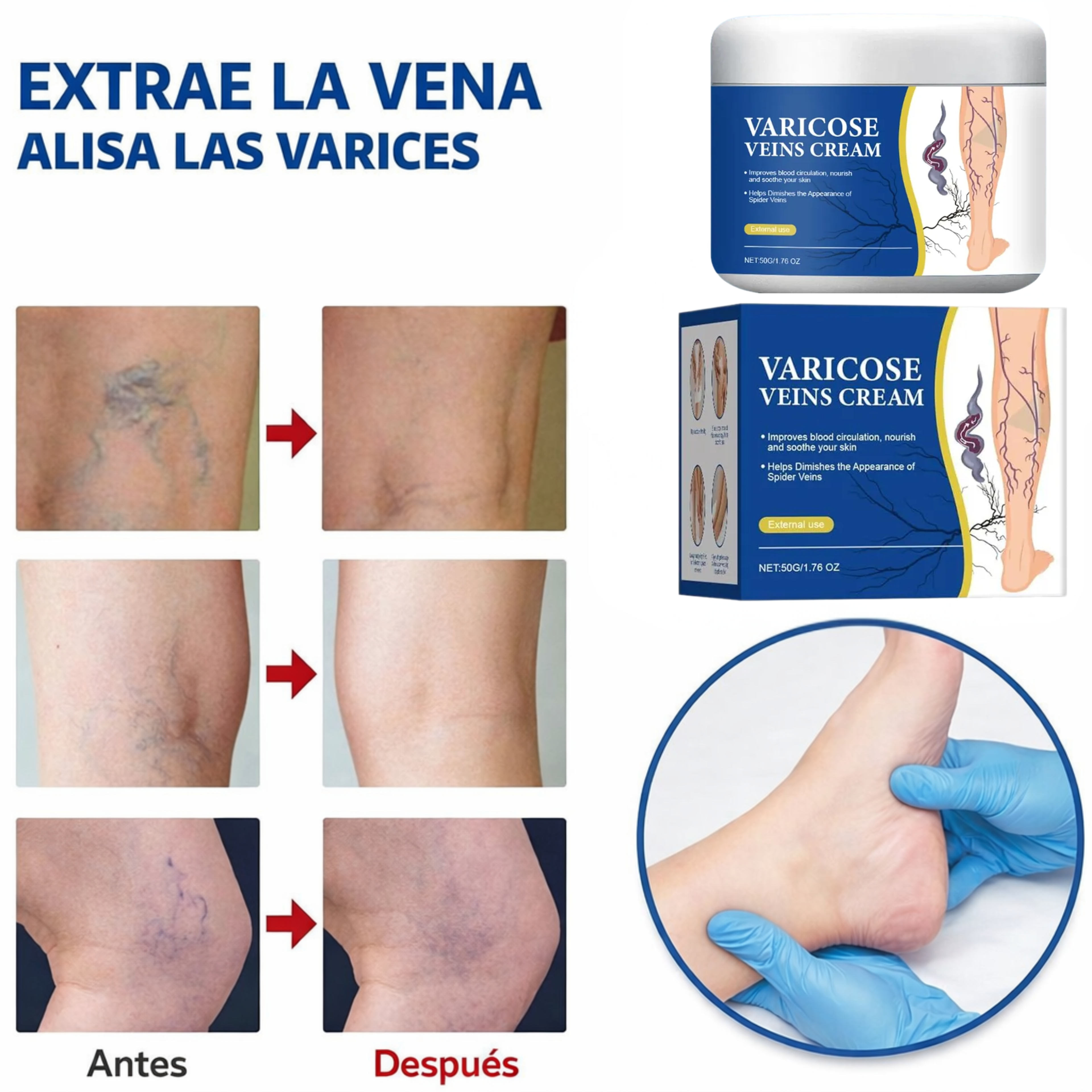 Varicose Vein Cream – Mejora la circulación y reduce la apariencia de varices.