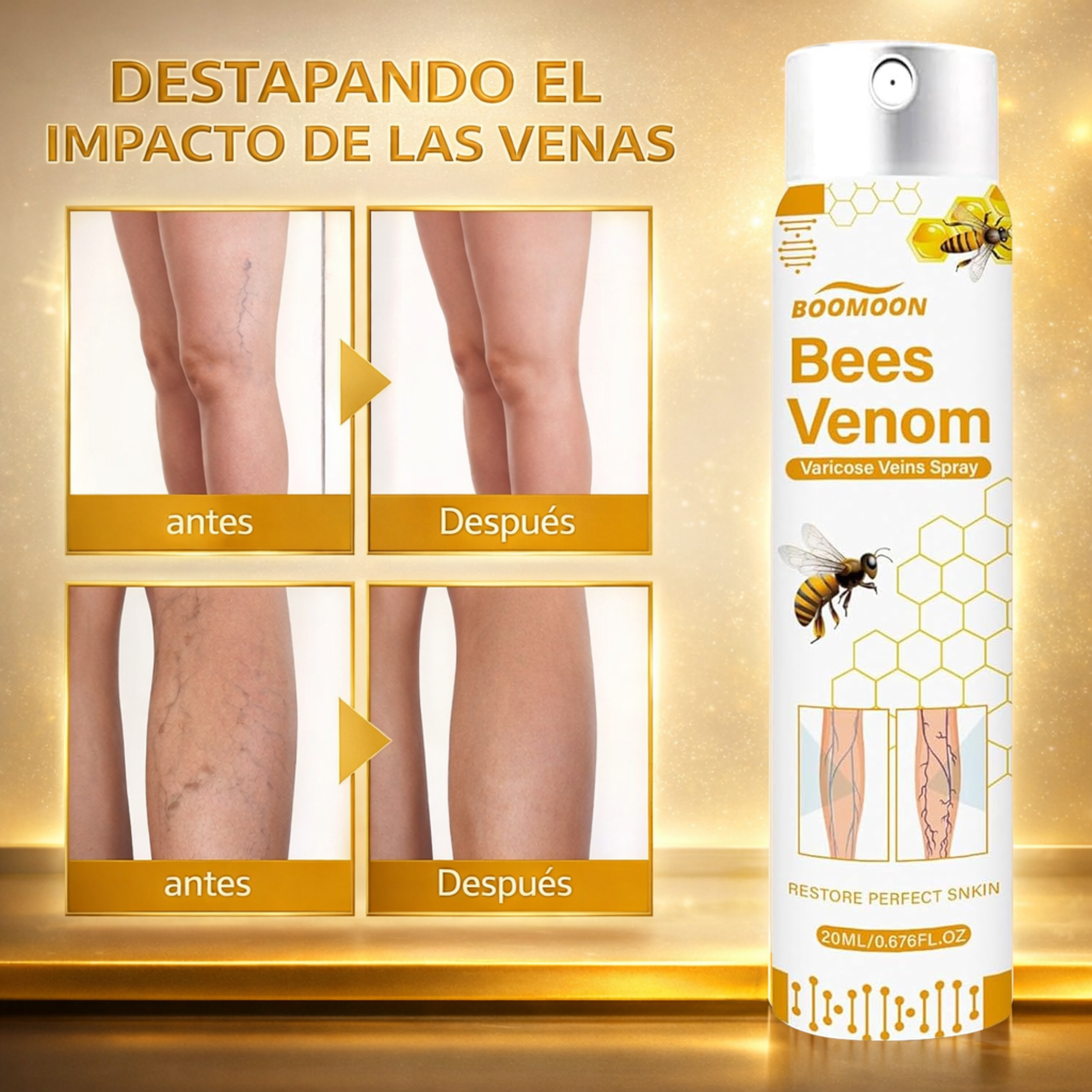 Bee Venom Varicose Spray – Alivio de la hinchazón causada por varices y arañitas.
