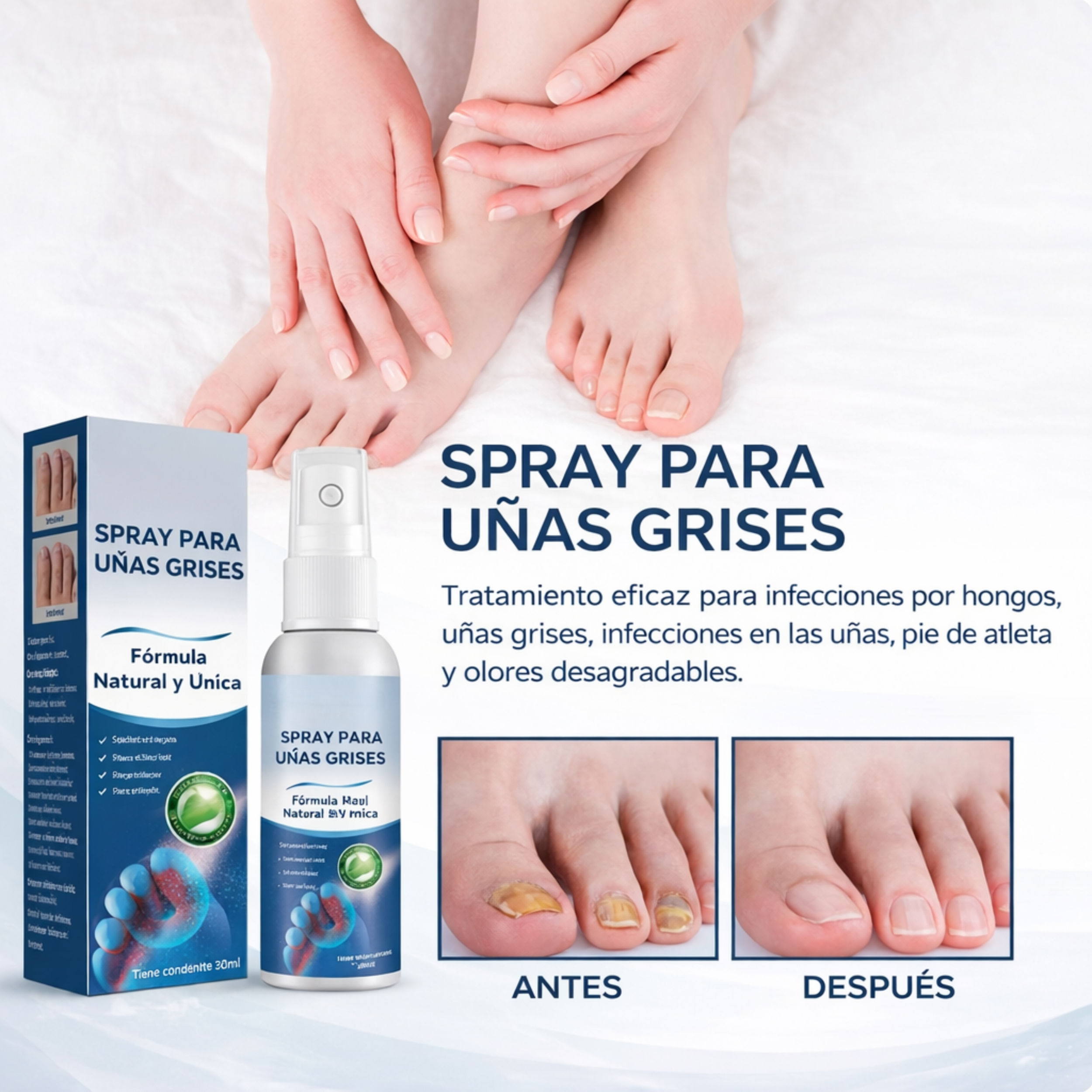 Spray para Uñas Grises - Cuidado efectivo antifúngico para uñas y pies