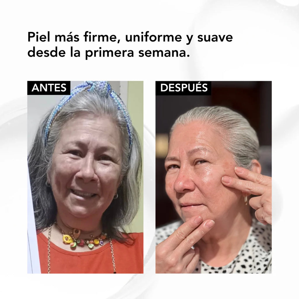 SUERO DE VITAMINA C PURA - Brillo visible. Resultados reales. Piel segura.