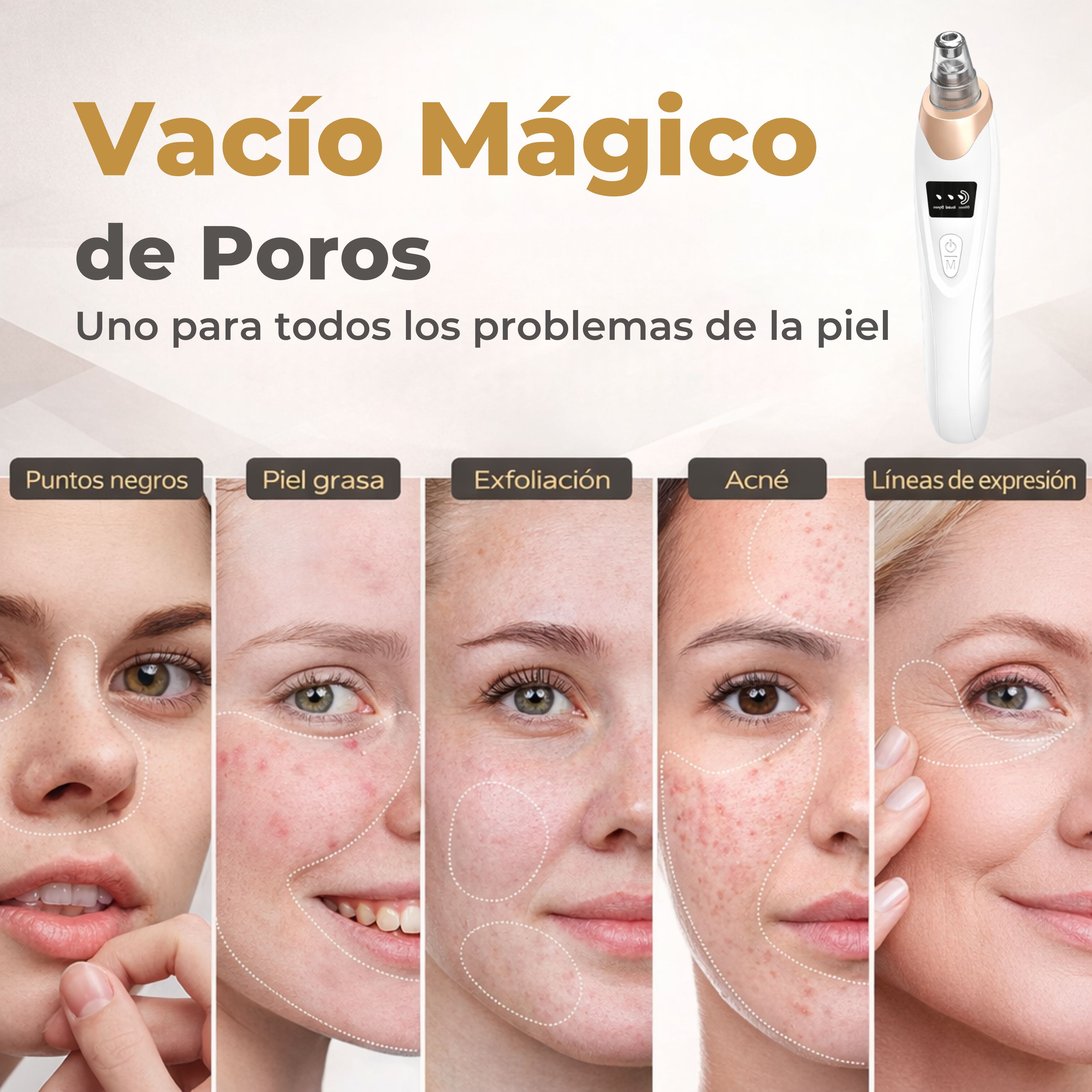 Aspirador de poros mágico – Solución para todos tus problemas faciales