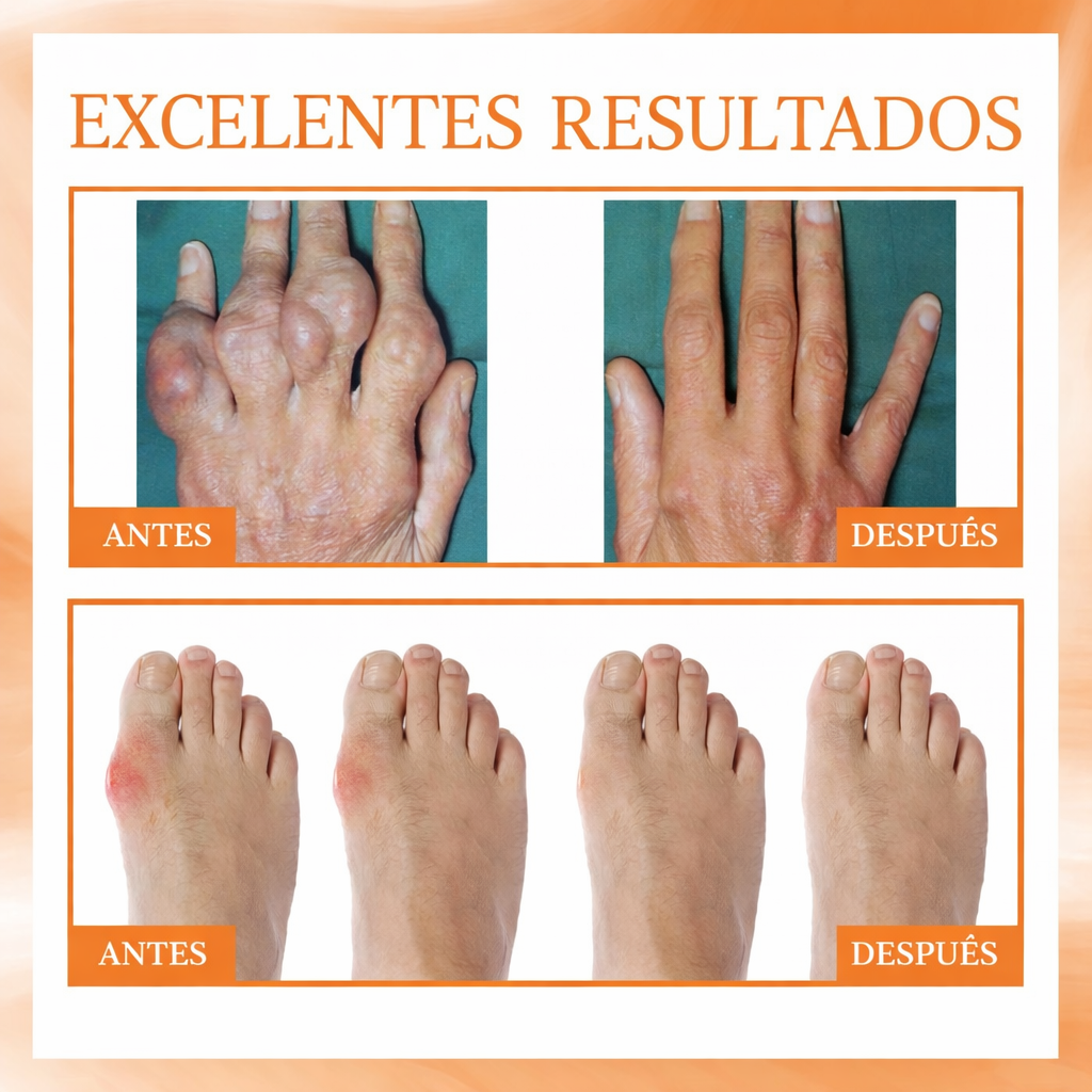 Bee Ease Spray - Spray de Cuidado Natural para el Dolor de Articulaciones y Huesos