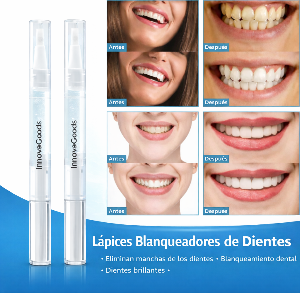 Pluma Blanqueadora Instantánea – Resultados Visibles en Días (Oferta 2x1)