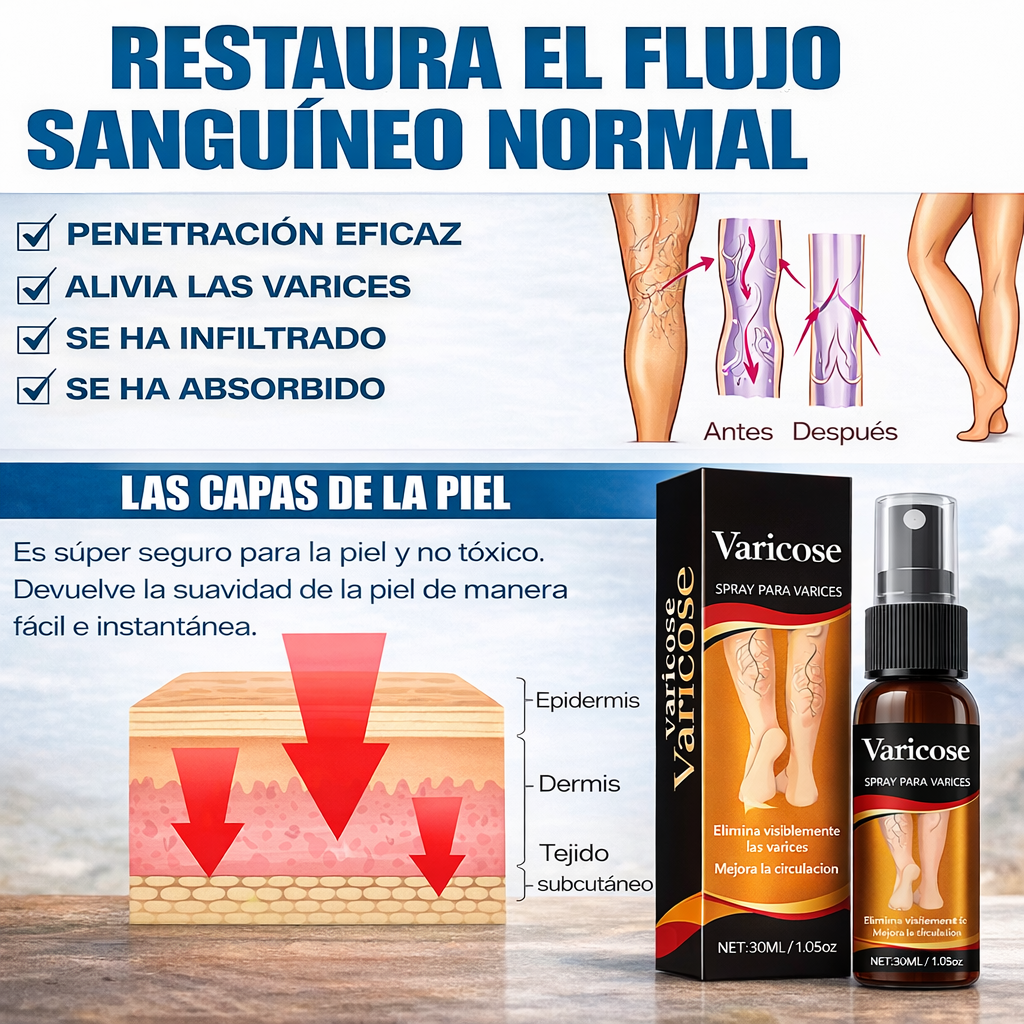 Spray para el alivio de las varices: fórmula natural de rápida absorción para la hinchazón, el dolor y el cansancio de las piernas.