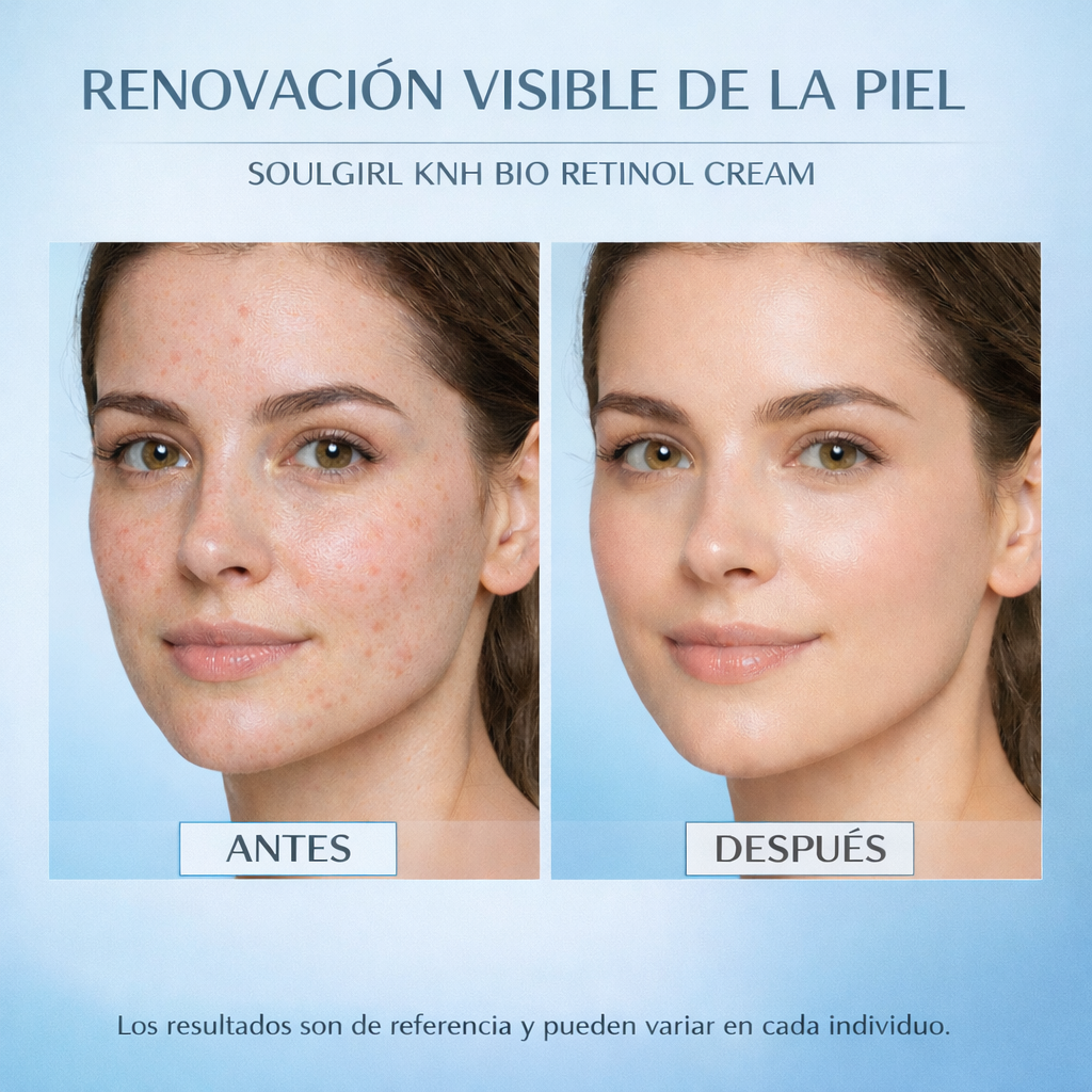 Crema SoulGirl KNH Bio Retinol: hidratación profunda, minimización de poros y reafirmación de la piel.