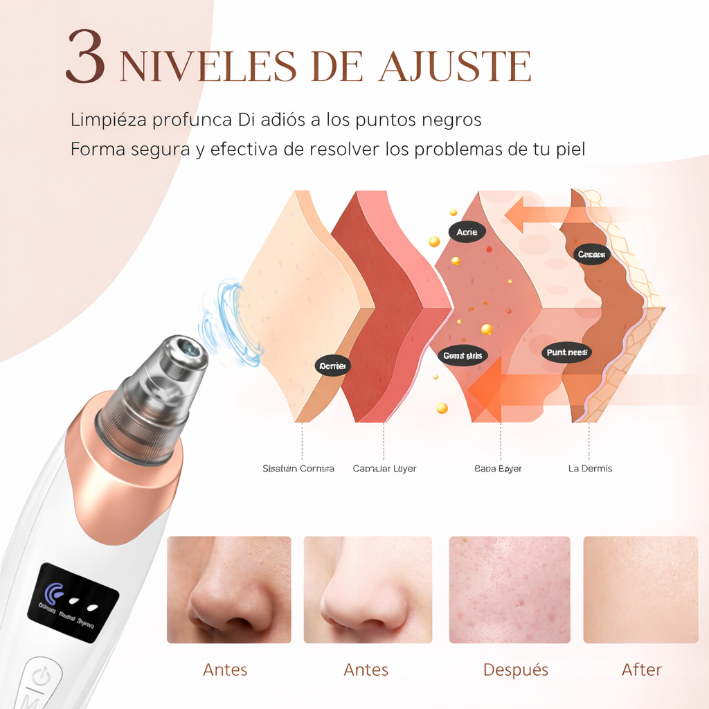 Aspirador de poros mágico – Solución para todos tus problemas faciales