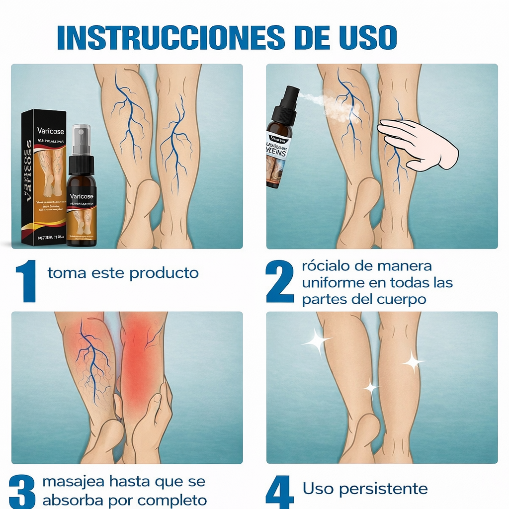 Spray para el alivio de las varices: fórmula natural de rápida absorción para la hinchazón, el dolor y el cansancio de las piernas.