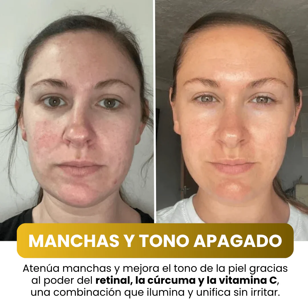 Mascarilla Facial Coreana con Cúrcuma y Colágeno